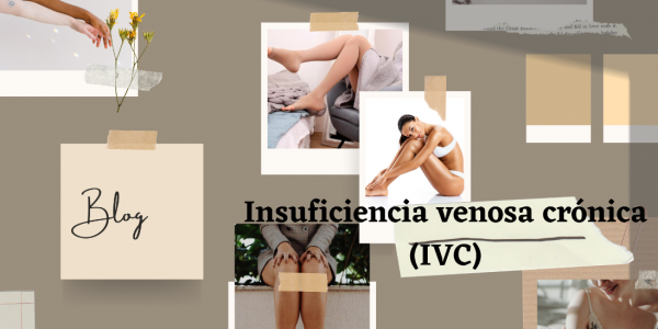 Insuficiencia venosa crónica (IVC)